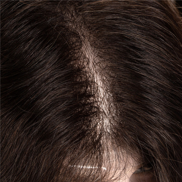 Hair Systems For Men
